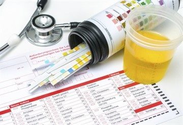 1a7d8c704627d8d6bfc7f4d38bc47aaf_360x246-360x246.jpg 1a7d8c704627d8d6bfc7f4d38bc47aaf_360x246-360x246-1