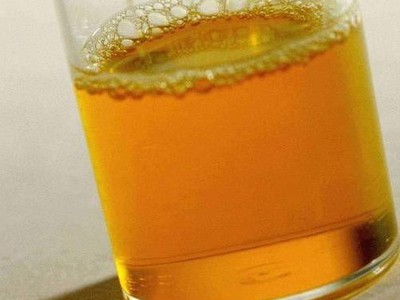 От чего зависит цвет мочи у женщин — Почки