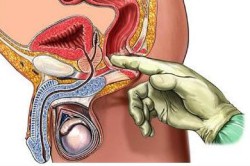 Функция предстательной железы у мужчин